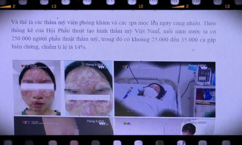 Y tế sức khỏe: Biến chứng sau phẫu thuật thẩm mỹ