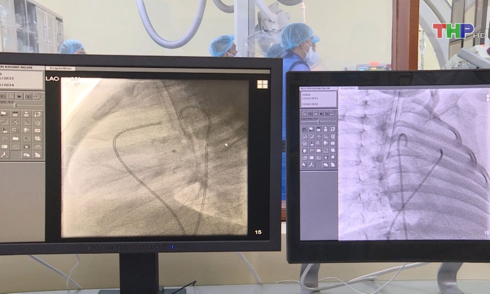 Can thiệp đ&oacute;ng ống động mạch th&agrave;nh c&ocirc;ng cho 3 bệnh nhi