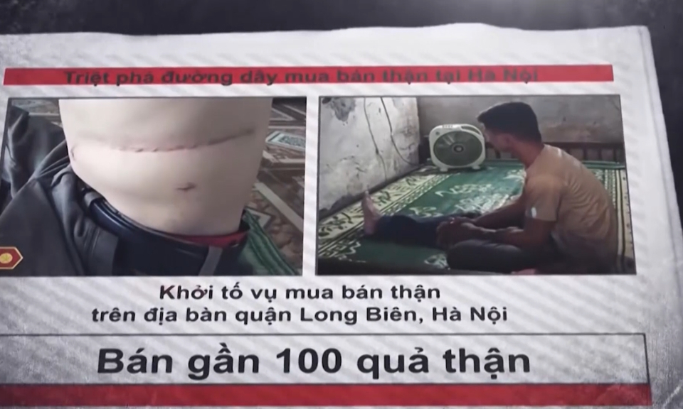 Tuổi trẻ Hải Ph&ograve;ng: Thanh ni&ecirc;n đồng h&agrave;nh chống nạn mua b&aacute;n người